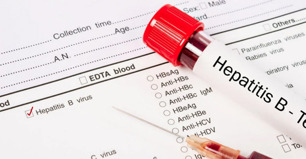 Hep. B Titers – NY Best Medical Care, PC